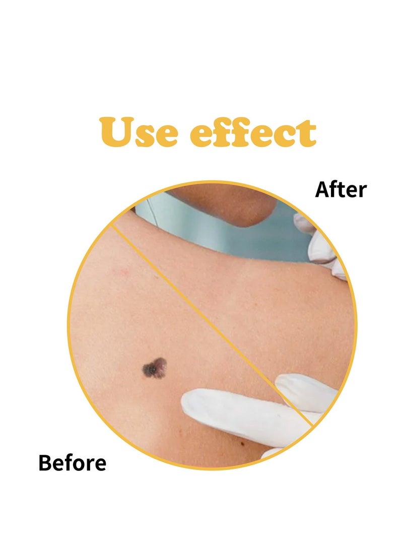 EELHOE Wart Removal Cream, 2024 New Bee Venom Repair Cream,A Gentle Safe Portable Wart Removal Cream with Natural Extracts for All Skin Typesï¼Universal for Both Men and Women Wart Removal (60g*2) - Image 3