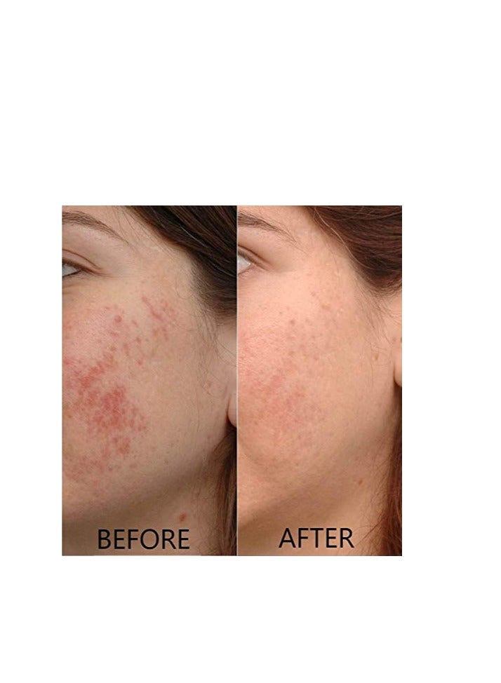 Dr Brenner Vitamin C Serum 20% Pure L-Ascorbic Acid, Ferulic Acid, Vitamin E and Hyaluronic Acid for Face and Eyes Natural Anti Aging Anti Wrinkle 1oz. by Dr. Brenner  - Image 3