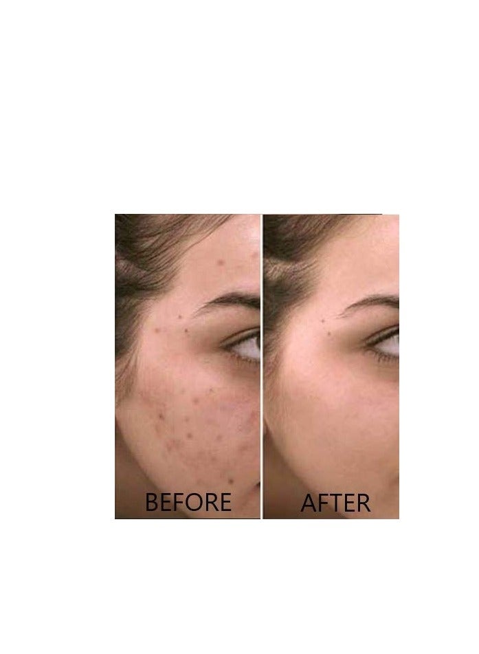 Dr Brenner Vitamin C Serum 20% Pure L-Ascorbic Acid, Ferulic Acid, Vitamin E and Hyaluronic Acid for Face and Eyes Natural Anti Aging Anti Wrinkle 1oz. by Dr. Brenner  - Image 4