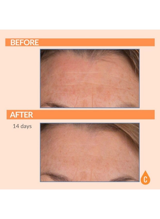 Serious Skincare - Vitamin C Skin Brightening Serum For Face - Anti-Aging C Ester Skin Conditioner - Hydrating C3 Plasma Hydrolyzed Collagen - Evens Skin Tone - Fine Lines & Wrinkles - 1 Fl. Oz.  - Image 2