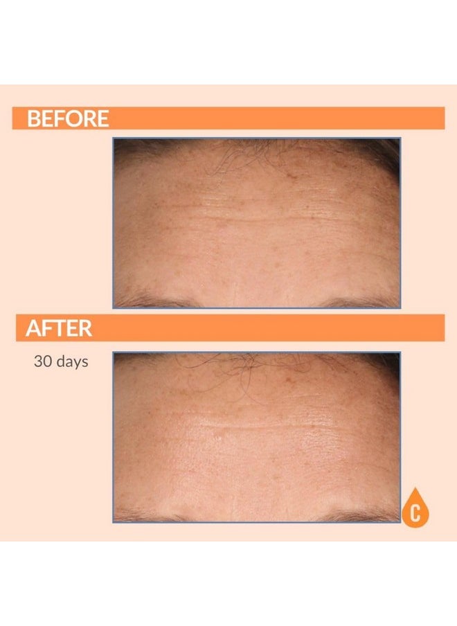 Serious Skincare - Vitamin C Skin Brightening Serum For Face - Anti-Aging C Ester Skin Conditioner - Hydrating C3 Plasma Hydrolyzed Collagen - Evens Skin Tone - Fine Lines & Wrinkles - 1 Fl. Oz.  - Image 3