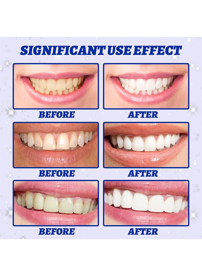 BIOAOUA 5D Teeth Whitening Strips ,3 Days Significant Whitening,Safe for Enamel,Remove Tough Stains and Easy Application 10PCS - Image 3