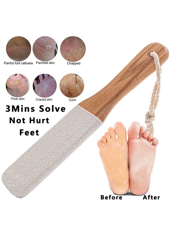 Kinepi Callus Remover Foot Scrubber Colossal Foot File Foot Care And Foot Exfoliator Foot Rasp Pedicure Tools Pumice Stone For Feetremove Corn Hard Skin Dead Skin For Use In Shower Foot Scraper Kit - Image 3