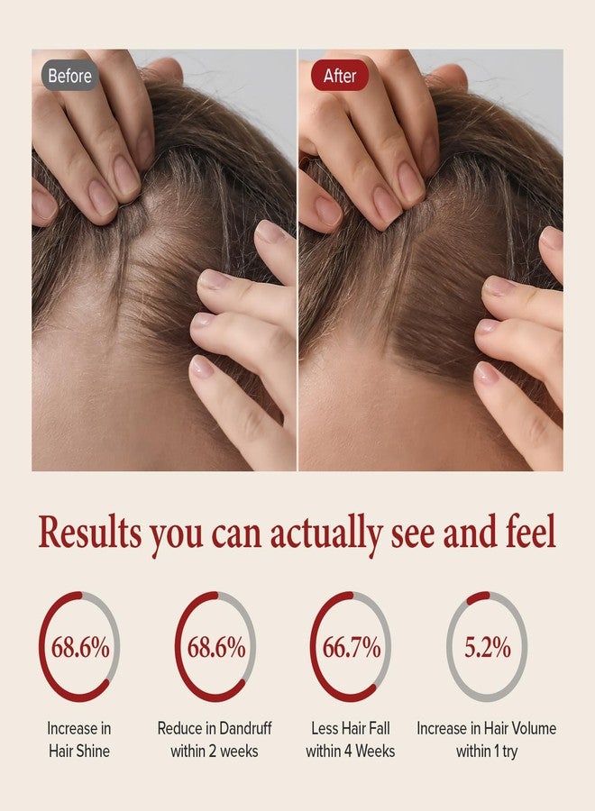 كاندال شامبو كوندال لفروة الرأس بالكافيين [بودرة الأطفال] - عناية كورية بالشعر خالية من الكبريتات مع المنثول ومستخلصات نباتية - لشعر أكثر كثافة، وانتعاش فروة الرأس، وقوة - 16.9 أونصة سائلة - Image 5