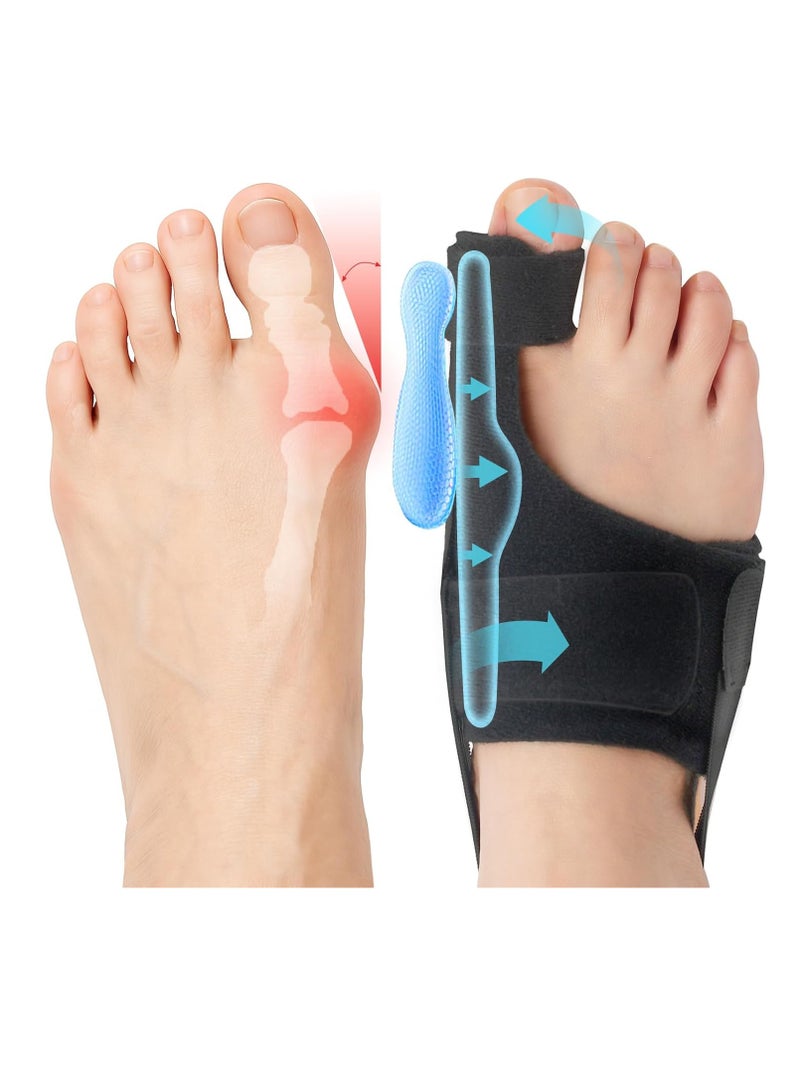 YelaJoy 2 Pack Bunion Corrector for Women and Men, Adjustable Big Toe Straightener for Bunion Relief-Hallux Valgus Pain Relief, Breathable Toe Corrector Brace Day and Night, Washable (Black) - Image 1
