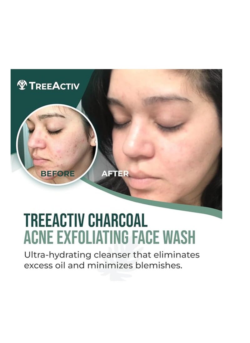 TreeActiv Acne Charcoal Face Wash Deep Cleansing Moisturizing Face Wash for Women and Men 3.4 oz  - Image 2