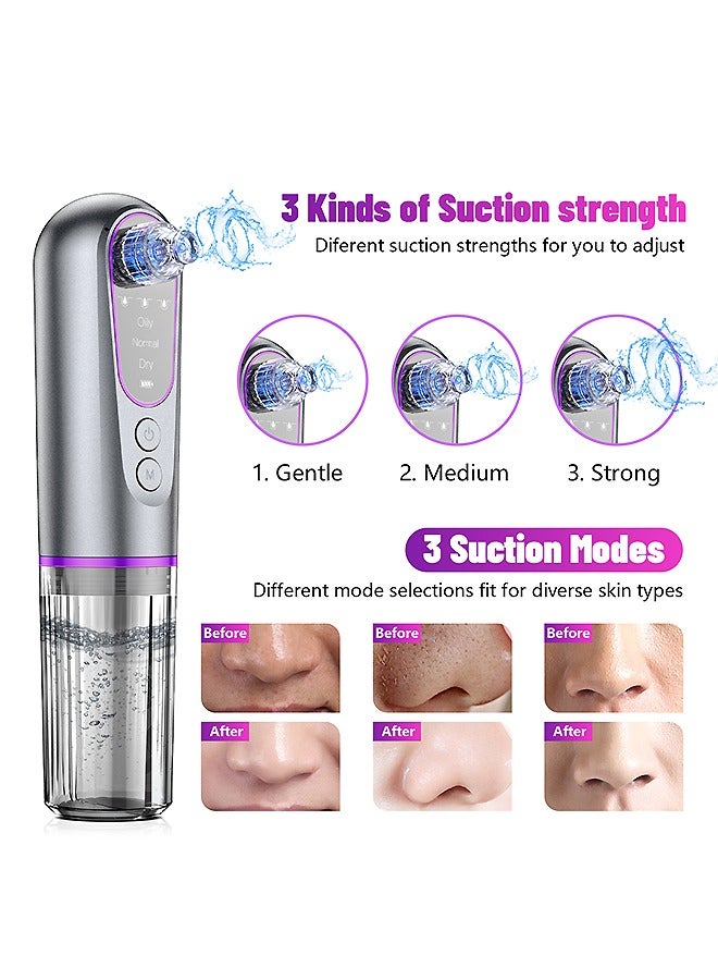 بيوند Blackhead Remover Pore Vacuum, Skin Rejuvenation LED Beauty Device, Blackhead Remover Vacuum Cleaning Instrument - Image 3