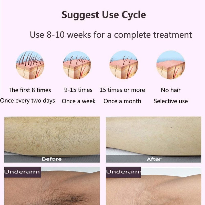 Mokshith Laser Hair Remover Long-Lasting IPL Hair Removal Device for Women and Men,5 Levels & 2 Modes, 300,000 Flashes Alternative to Salon At Home Epilator for Armpits Legs Arms Bikini Line (MO-03) - Image 4