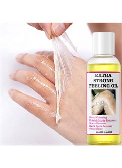 MOOYAM Extra Strong Peeling Oil,Yellow Peeling Oil 110ml Super Strength Dead Skin Remover Skin Moisturizing Hydrating Butter Peeling Remove Dead Skin and Calluses on Feet and Hand Dark Spot Peeling Oil  - Image 1