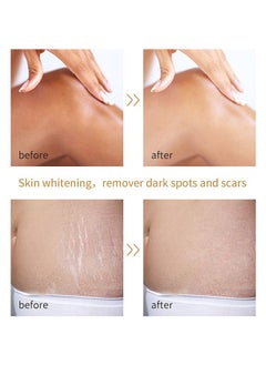 MOOYAM Extra Strong Peeling Oil,Yellow Peeling Oil 110ml Super Strength Dead Skin Remover Skin Moisturizing Hydrating Butter Peeling Remove Dead Skin and Calluses on Feet and Hand Dark Spot Peeling Oil  - Image 2