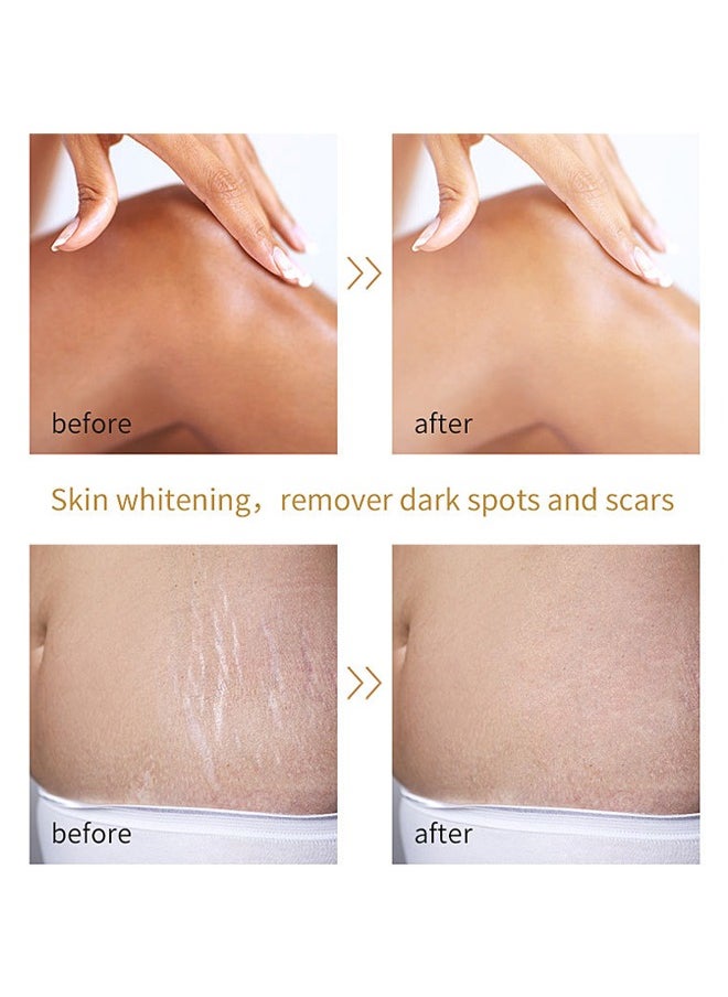 MOOYAM Extra Strong Peeling Oil,Yellow Peeling Oil 110ml Super Strength Dead Skin Remover Skin Moisturizing Hydrating Butter Peeling Remove Dead Skin and Calluses on Feet and Hand Dark Spot Peeling Oil  - Image 2