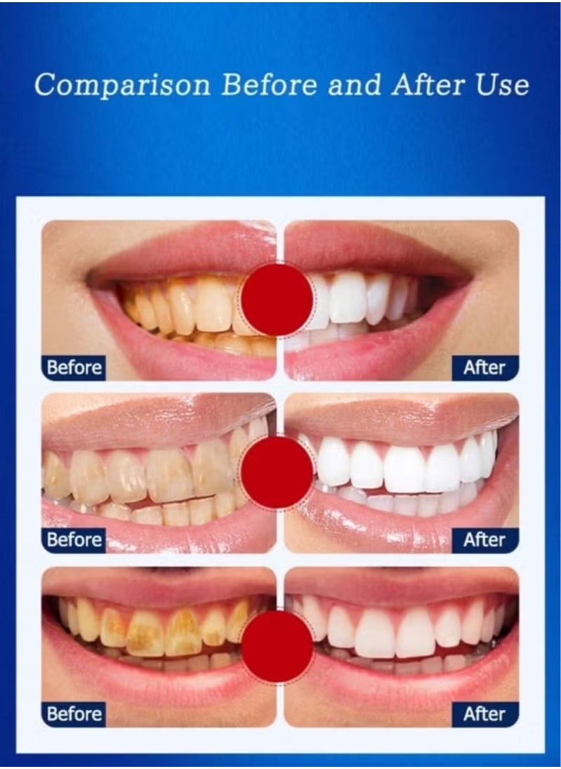 SMILEKIT - 9D White Teeth Whitening Strips Advanced Fast Effective 3 Days (New-9D-7set) - Image 1