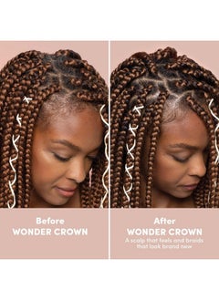 Mizani Mizani Wonder Crown Scalp Cleanser | Dry Scalp and Dandruff Treatment | Helps Stimulate Hair Growth | Removes Buildup and Oil | With Tea Tree and Peppermint Oil | For Dry, Itchy Scalps | 6.8 fl oz  - Image 5
