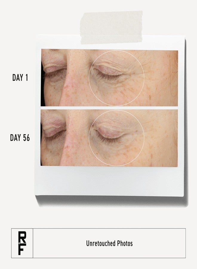 Rodan Fields RODAN + FIELDS Redefine Eye Cream | 15 ml | Vitamin C & F Moisturizer for Hydrated, Radiant Eyes | Supports Younger Looking Eyes | Smooths Puffiness - Image 2