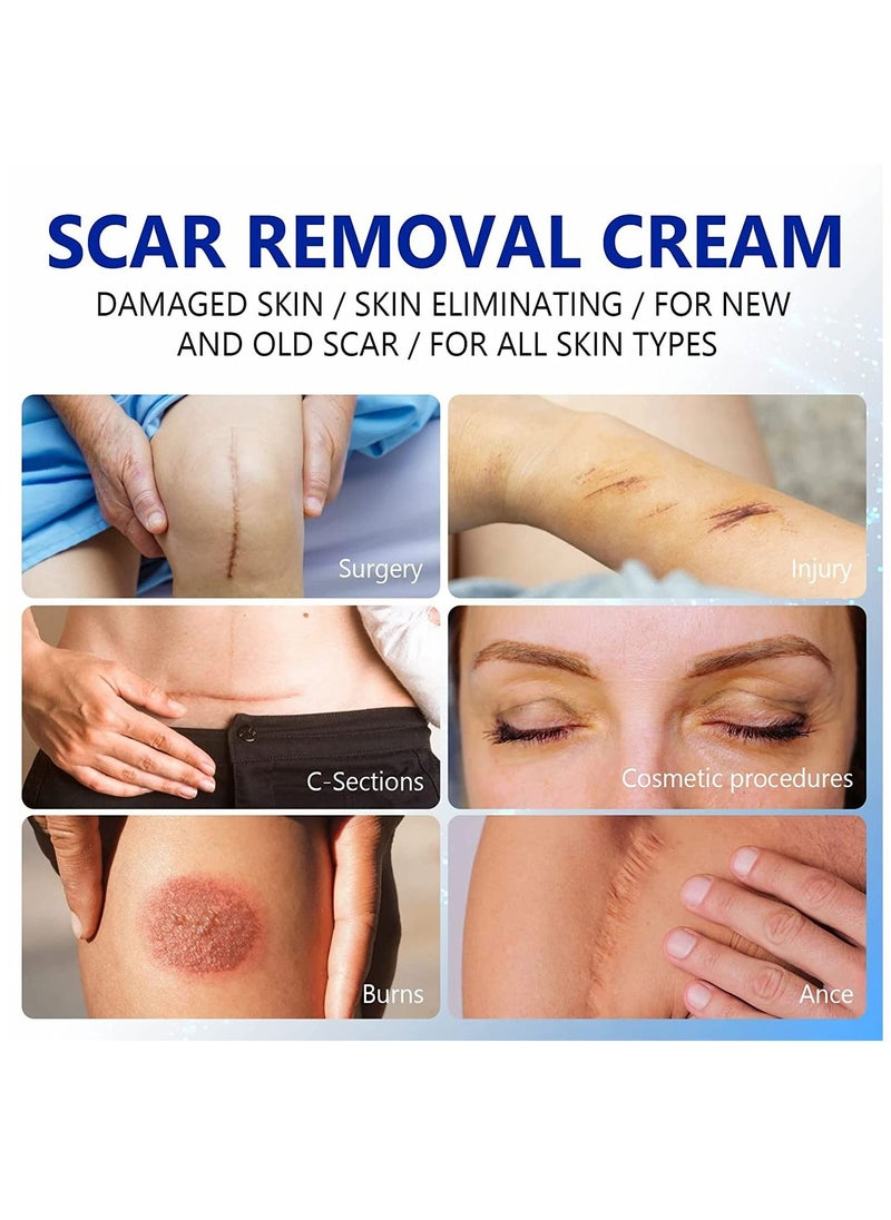 Elaimei - Damaged Skin Acne Scar Cream For Day & Night Usage Fade Away Pimple Marks Blemishes Dark Spots & Other Forms Of Scars Reduces the Appearance Of Old & New Scars For All Skin Types Unisex (50 ml) - Image 1