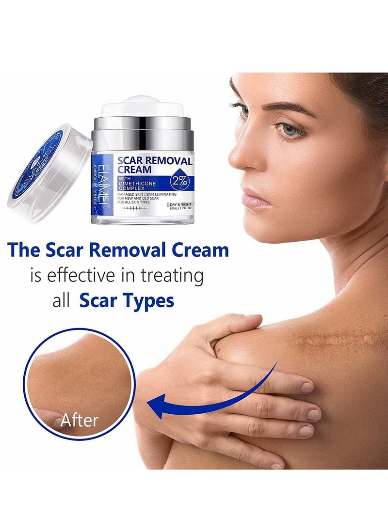 Elaimei - Damaged Skin Acne Scar Cream For Day & Night Usage Fade Away Pimple Marks Blemishes Dark Spots & Other Forms Of Scars Reduces the Appearance Of Old & New Scars For All Skin Types Unisex (50 ml) - Image 1