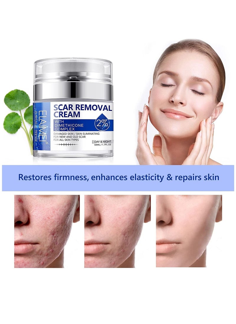 Elaimei - Damaged Skin Acne Scar Cream For Day & Night Usage Fade Away Pimple Marks Blemishes Dark Spots & Other Forms Of Scars Reduces the Appearance Of Old & New Scars For All Skin Types Unisex (50 ml) - Image 1