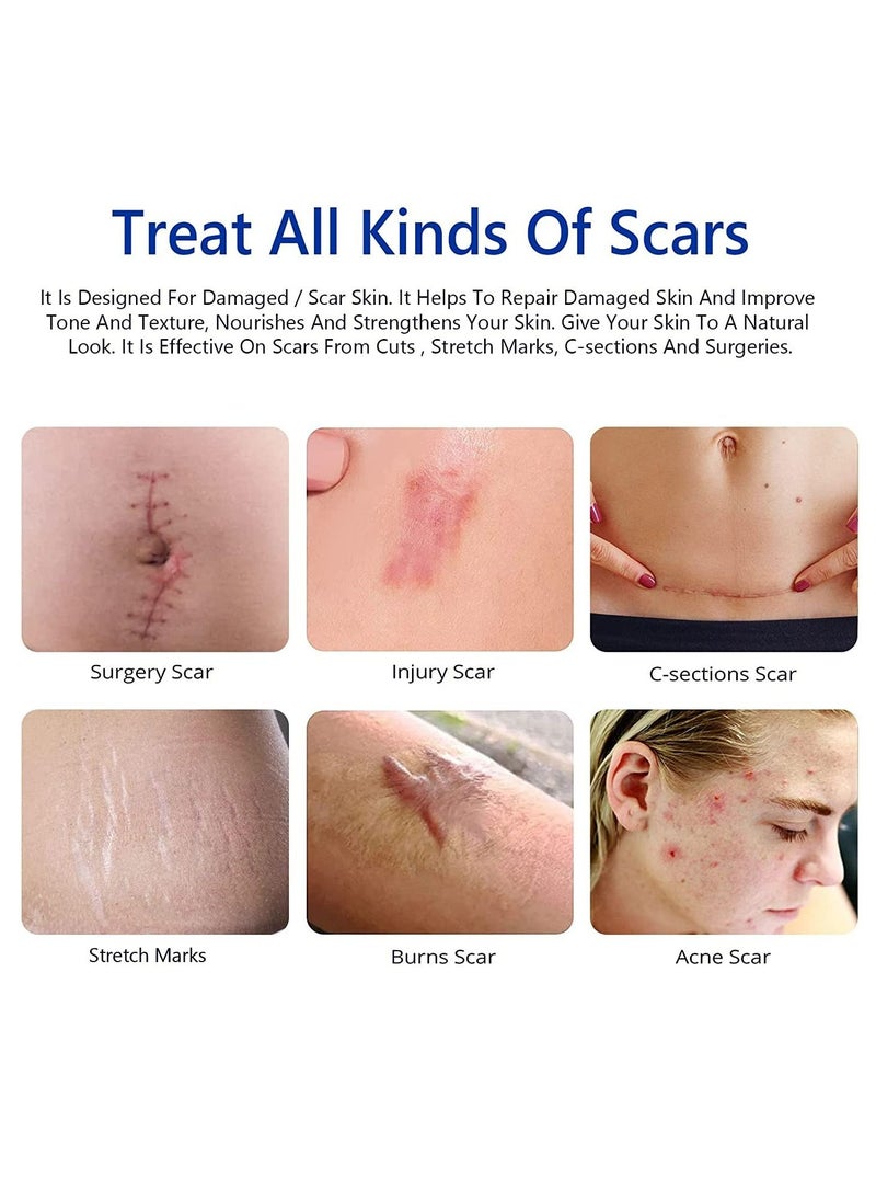 Elaimei - Damaged Skin Acne Scar Cream For Day & Night Usage Fade Away Pimple Marks Blemishes Dark Spots & Other Forms Of Scars Reduces the Appearance Of Old & New Scars For All Skin Types Unisex (50 ml) - Image 1