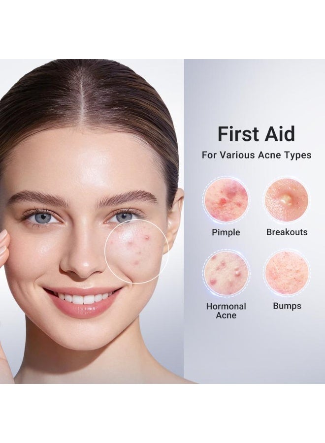 Dr.Leo Drying Lotion Plus | Acne & Pimple Treatment | Visibly Shrinks Pimples in 24 Hours & Helps Fade Acne Marks in 7 Days | With 1.8% Encapsulated Salicylic Acid, 4% Niacinamide & 10% Sulfur (20ml) - Image 4