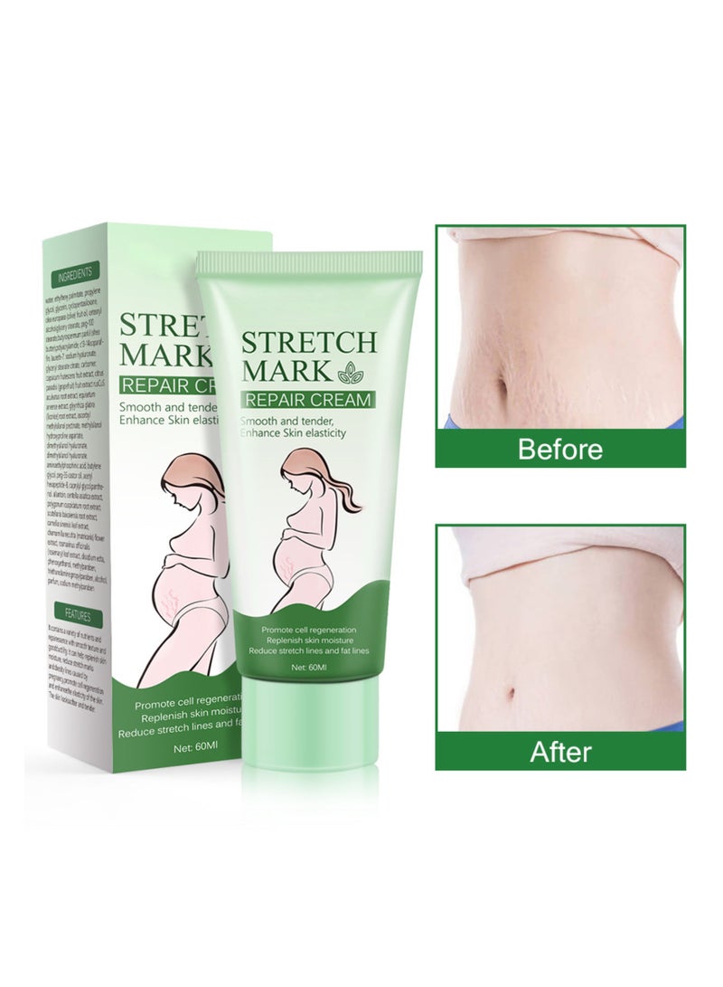 SYOSI Stretch Marks Removal, Pregnancy Stretch Mark Cream, Scar Removal Cream for Stretch Marks for Face Body Scar - Image 4