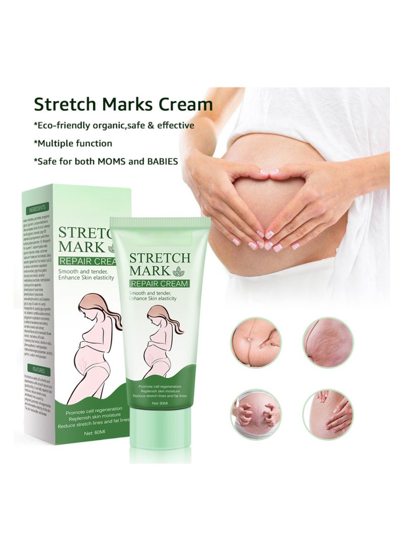SYOSI Stretch Marks Removal, Pregnancy Stretch Mark Cream, Scar Removal Cream for Stretch Marks for Face Body Scar - Image 1