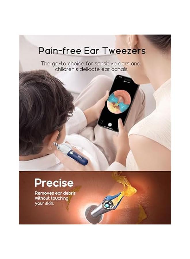 Bebird Earsight Plus R37R Ear Cleaning Camera Wax Removal Tool kit, Flexible Ear Scope Otoscope Camera Light, Visual Ear Picker Wireless Earwax Remover Tweezers for Adults & Kids - Image 4