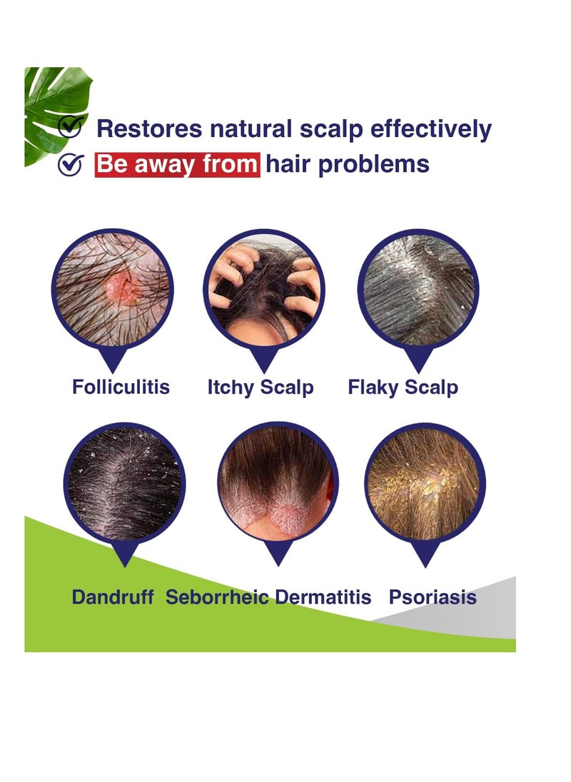 Anti-Fungal Shampoo for Folliculitis, Seborrheic Dermatitis, Scalp Psoriasis - Relieves Itchy & Dry Scalp