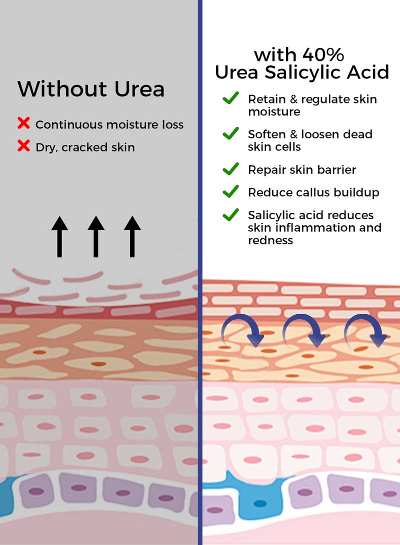 OUKEYA Urea Cream with Salicylic Acid Foot Cream -Intensive Moisturizing for Extremely Dry Skin on Hands, Feet and Elbows  - Image 3