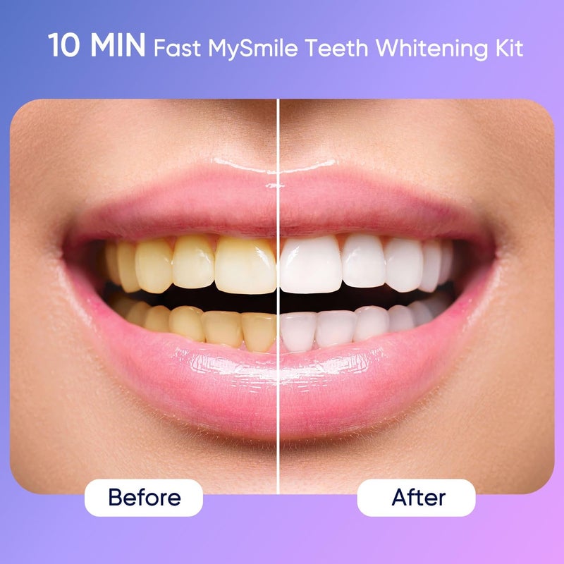 MySmile Deluxe 10 Min Teeth Whitening Kit with 28 LED Light, 35% Carbamide Peroxide Teeth Whitening Gel, Helps Remove Years of Stains from Coffee, Soda, Wines, Smoking, Food - Image 2