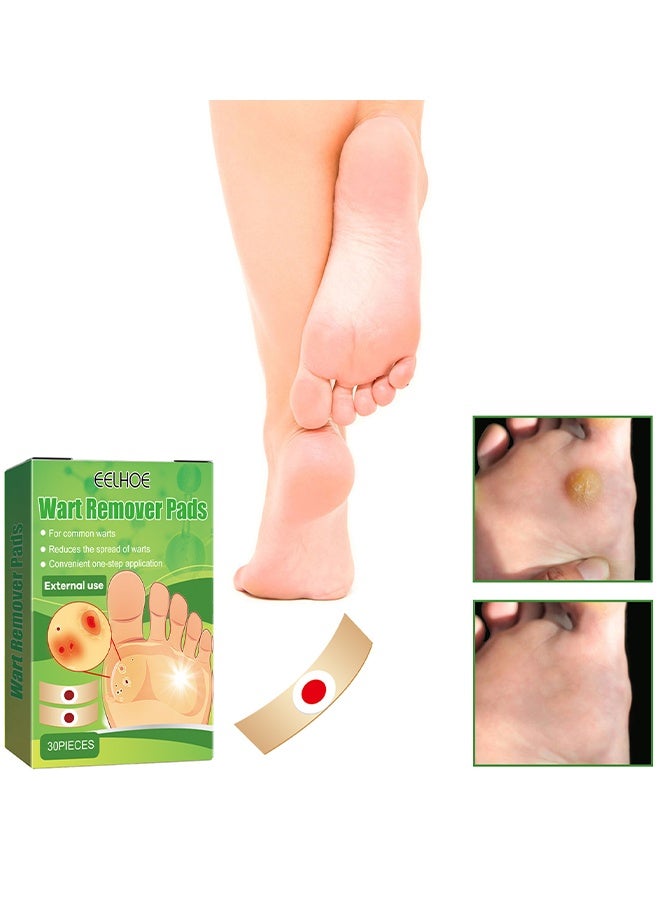 EELHOE 30 Pcs Wart Removal Pads, Treatment Relief Corn Pain And Foot Care, Clean Anti-Itting And Antibacterial Patches, External Use - Image 2