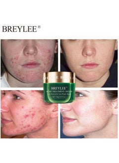 Breylee Acne Treatment Cream, Tea Tree Oil Acne Cream for Clearing Severe Acne, Breakout, Remove Pimple and Repair Skin 20g  - Image 1