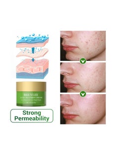 Breylee Acne Treatment Cream, Tea Tree Oil Acne Cream for Clearing Severe Acne, Breakout, Remove Pimple and Repair Skin 20g  - Image 2