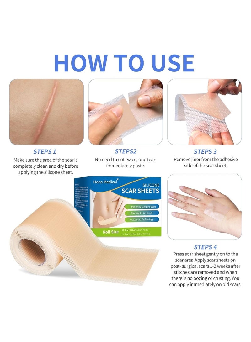 HONS Medical Grade Silicone Scar Tape 4x200cm Roll-2M),Upgrade Adhesives Silicone Scar Sheets with Pre-Cut Lines,Scar Removal Sheets Works on Old & New Scars,Non-Irritable to Skin, Latex and Teflon Free  - Image 2