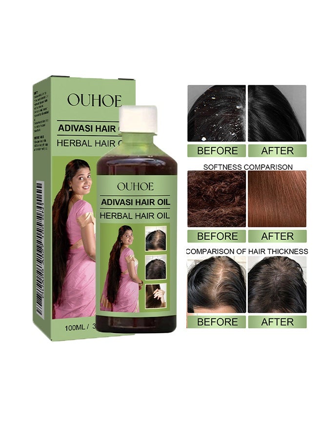 OUHOE Hair Oil - Original Hair Growth Oil 3 IN 1 Original Hair Growth Oil |  Herbal Kesh tel with Natural Rosemary essential & Biotin for Control Hairfall anti dandruff 100ml - Image 1