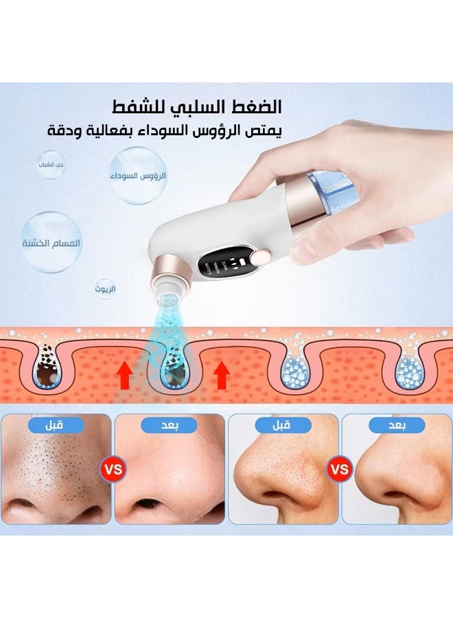 جهاز شفط مسام الوجه - 3 إعدادات شفط قابلة للتعديل، 6 رؤوس مرفقة - جهاز إزالة الرؤوس السوداء قابل لإعادة الشحن عبر منفذ USB - Image 3