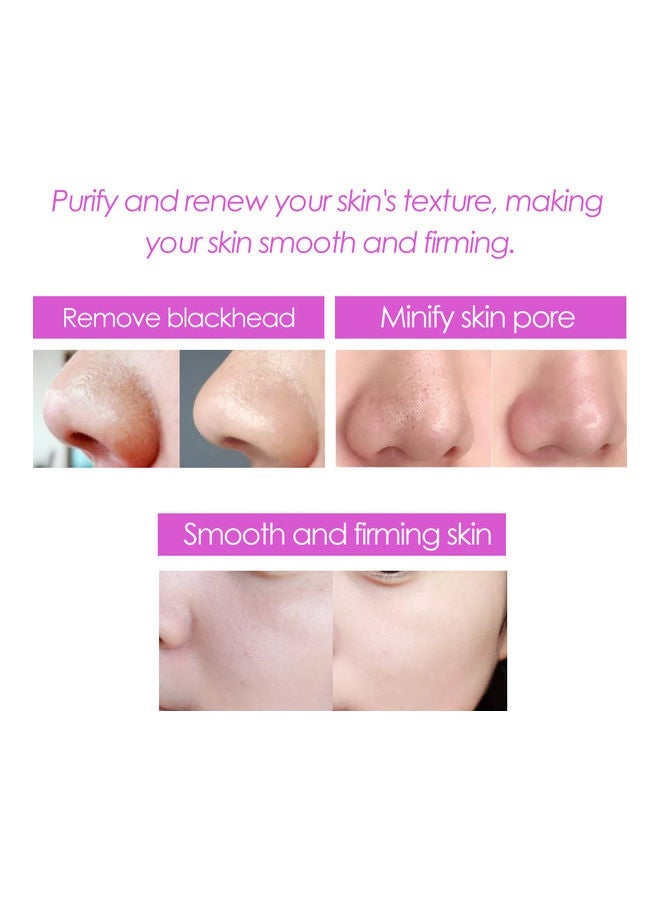 NIBEMINENT Ultrasonic Facial Skin Scrubber White - Image 3