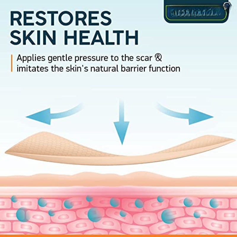 Silicone Scar Sheets 5.7" X 1.57" 4 Pack Advanced Silicone Treatment - Medical-Grade Ingredient Scar Tape - Easy To Apply & Remove Scar Strips for Post-Surgery Keloid C-Section Scar Treatment - Image 3