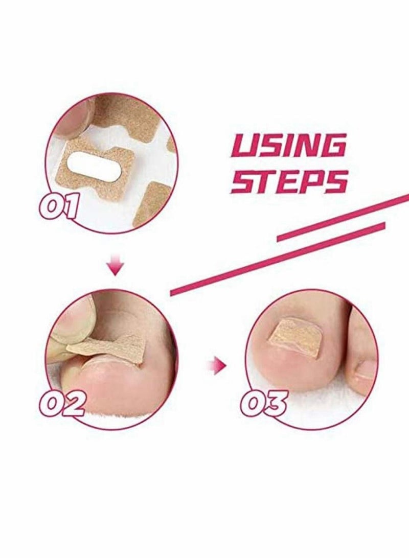 KASTWAVE Ingrown Toenail Correction Stickers, Glue-free Ingrown Toenail Corrector Strips, Painless Pedicure Toenail Corrector Patch Professional Toenail Treatment Tool Foot Care(100 PCS) - Image 3