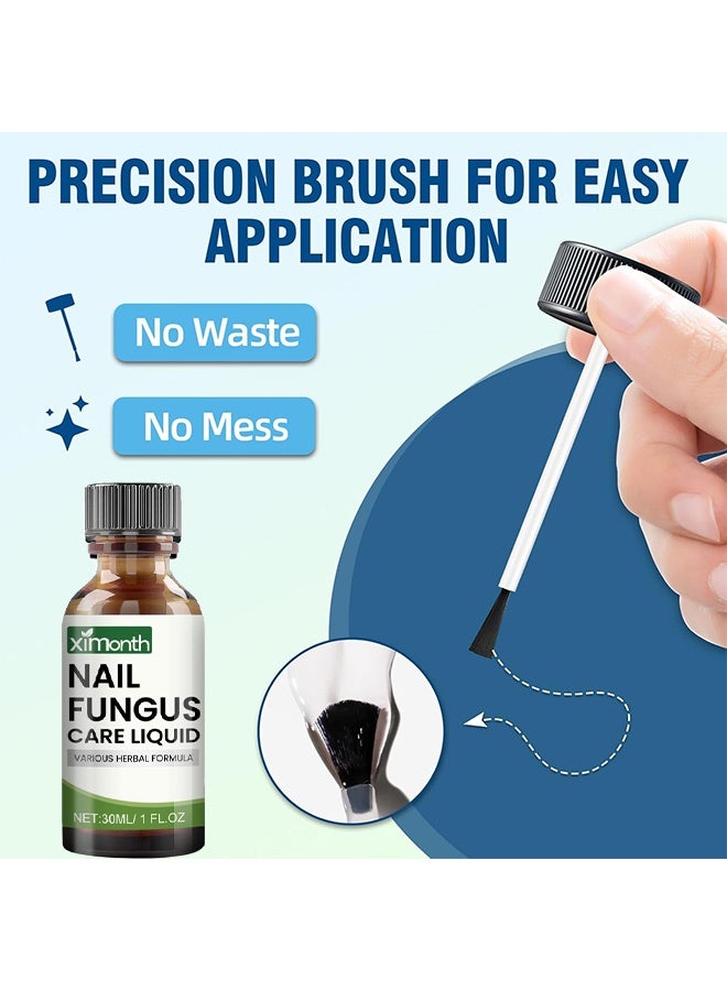 ximonth Nail Fungus Care Liquid, Toenail Fungus Treatment Extra Strength, Natural Plant Extract Nail Care For Damaged & Discolored, Toe Nail Fungus Treatments, Fungus Nail Treatment, ToeNail Fungus Treatments For Thick, Broken, Discolored & Damaged Nail, 30ml - Image 3