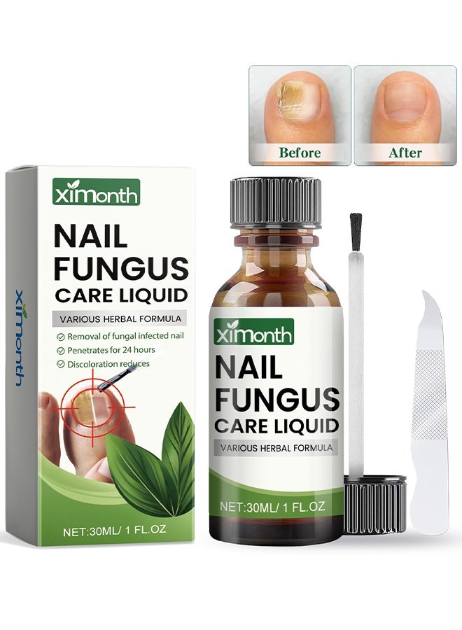 ximonth Nail Fungus Care Liquid, Toenail Fungus Treatment Extra Strength, Natural Plant Extract Nail Care For Damaged & Discolored, Toe Nail Fungus Treatments, Fungus Nail Treatment, ToeNail Fungus Treatments For Thick, Broken, Discolored & Damaged Nail, 30ml - Image 1