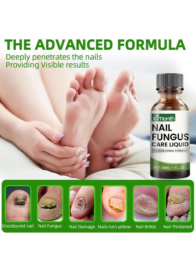 ximonth Nail Fungus Care Liquid, Toenail Fungus Treatment Extra Strength, Natural Plant Extract Nail Care For Damaged & Discolored, Toe Nail Fungus Treatments, Fungus Nail Treatment, ToeNail Fungus Treatments For Thick, Broken, Discolored & Damaged Nail, 30ml - Image 4