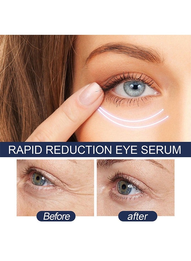 EELHOE Rapid Reduction Eye Serum, Anti Aging Serum Visibly Reduces Under-Eye Bags, Wrinkles, Dark Circles, Fine Lines And Crow's Feet Instantly - Image 5