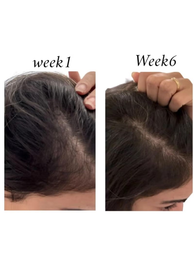 رو أفريكان بخاخ مُعزز لبصيلات الشعر - (١٢٥ مل) | مُحفز لنمو الشعر | علاج يومي لتكثيف الشعر خالٍ من الزيوت - Image 2