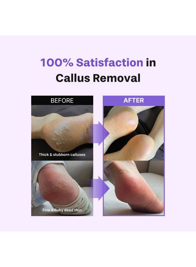 BAREN Foot Callus Remover Kit |1-Min Spray & Peel |13 Naturally derived ingredients |Professional Level Gentle Removal of Dead Skin |Premium Grade Stainless Steel |3.3oz Callus Peeling Spray+Foot File - Image 4