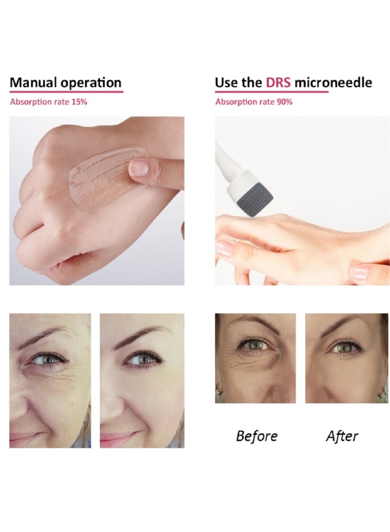 hydra DRS 140 2.0mm Stainless Steel Needle Derma Roller Stamp - Image 4