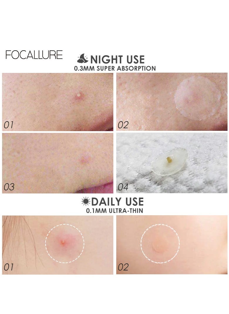 FOCALLURE - Invisible Acne Pimple Patch for Night Use 2 Pcs - Image 1