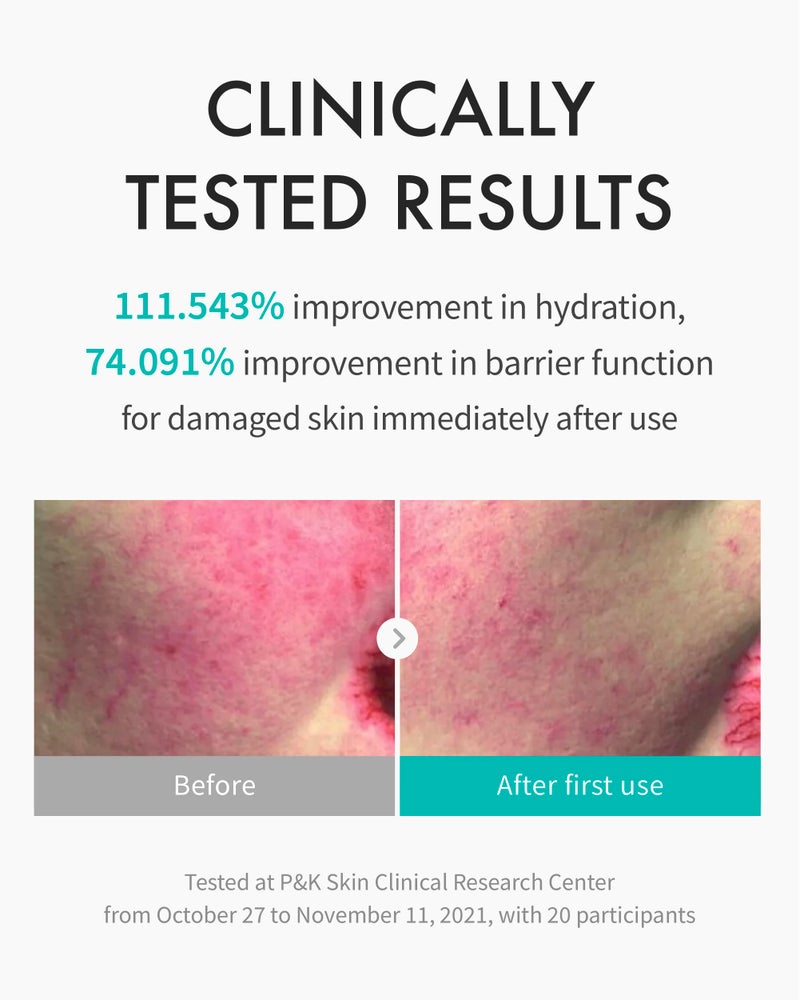 REJURAN أمبولات علاج الرطوبة REJURANÂ®، c-PDRNÂ® - سيروم وجه مرطب عميق للرطوبة الفورية والدائمة، مهدئ، تعزيز حاجز البشرة، قفل الرطوبة مع PDRx. العناية بالبشرة الكورية (1.01 أونصة سائلة) - Image 3