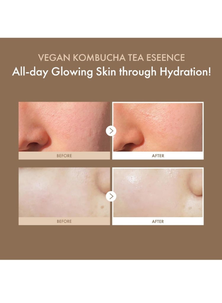 علاج الجفاف وضعف حاجز البشرة – Dr.Ceuracle Vegan Kombucha Tea Essence لترطيب عميق، موازنة البشرة وإشراقة صحية (150ml) - Image 2