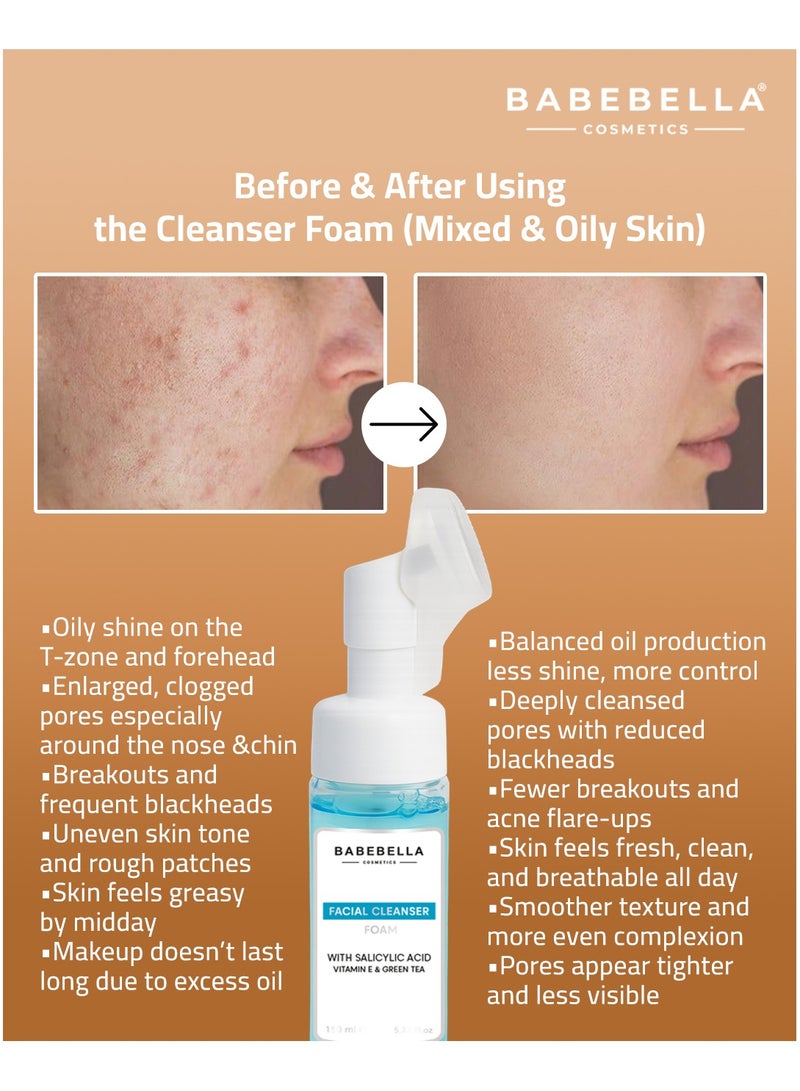 Babebella Cosmetics Salicylic Acid Facial Foam Cleanser Clears Breakouts, Controls Oil, Purifies Pores, and Targets Acne for Mixed to Oily Skin 150ml  - Image 4