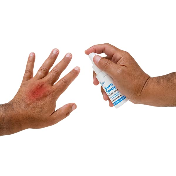 Globe بخاخ حروق جلوب، ليدوكائين 2%. مسكن موضعي لتخفيف الألم والتخدير 2 أونصة زجاجة بخاخ - Image 5